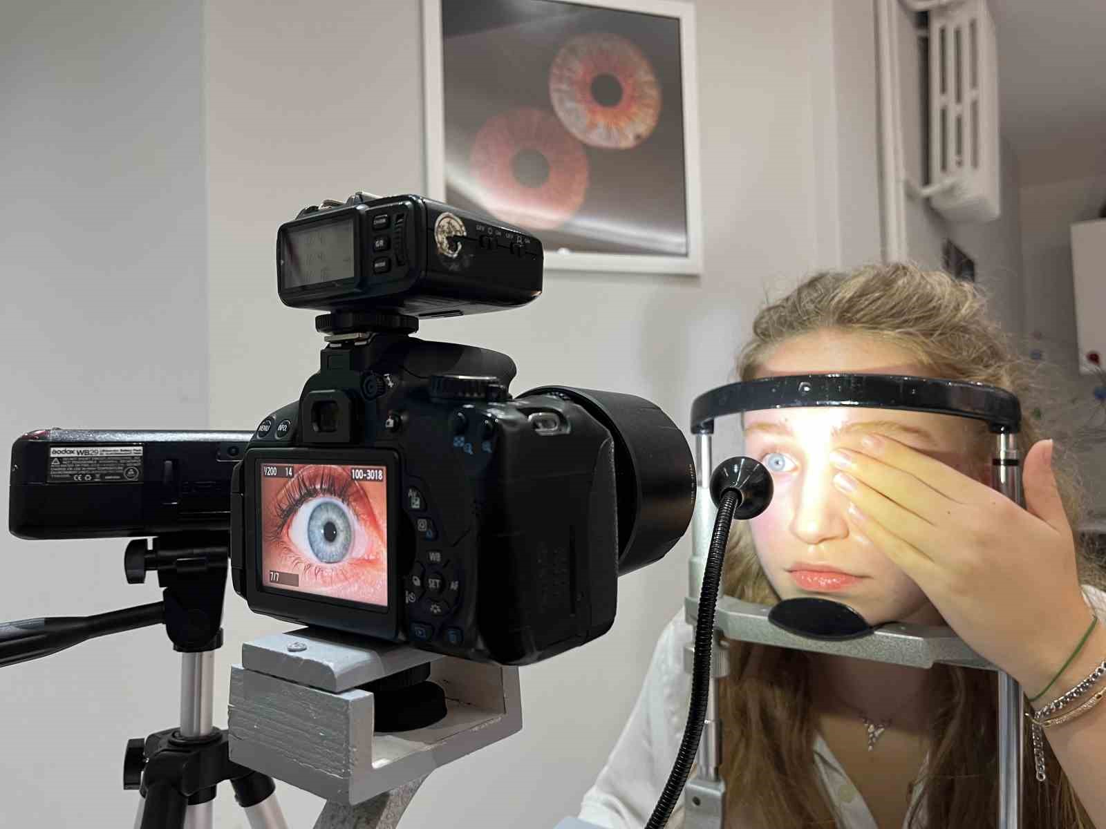 Eren Alp, Iris Fotoğrafçılığı ile Gözleri Eşsiz Aksesuarlara Dönüştürüyor